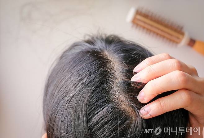 탈모