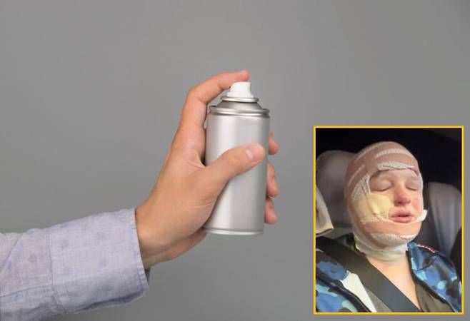 먼지 제거용 스프레이를 라이터로 가열하려다 불이 옷에 옮겨 붙으면서 얼굴과 목, 손에 화상을 입은 13살 소년의 사연이 전해졌다.배경이미지=게티이미지뱅크/ 하단 사진= 가족제공