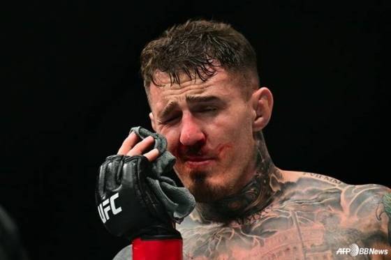 톰 아스피날이 시릴 가네와 경기 중 눈을 찡그리며 고통스러워하고 있다. /AFPBBNews=뉴스1