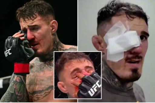 톰 아스피날. /사진=영국 더선 갈무리