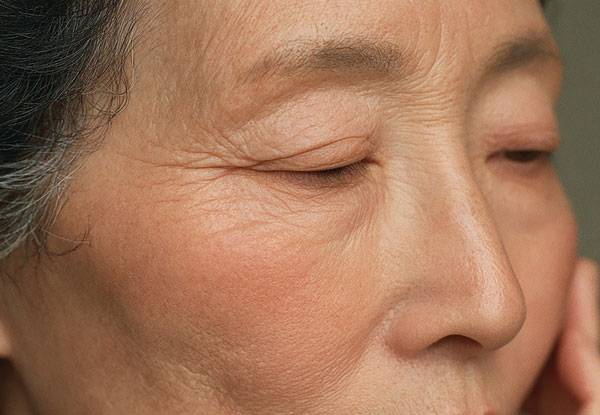 눈가 주름이 향후 치매 위험을 가늠할 수 있는 단서가 될 수 있다는 연구 결과가 나왔다./사진=클립아트코리아
