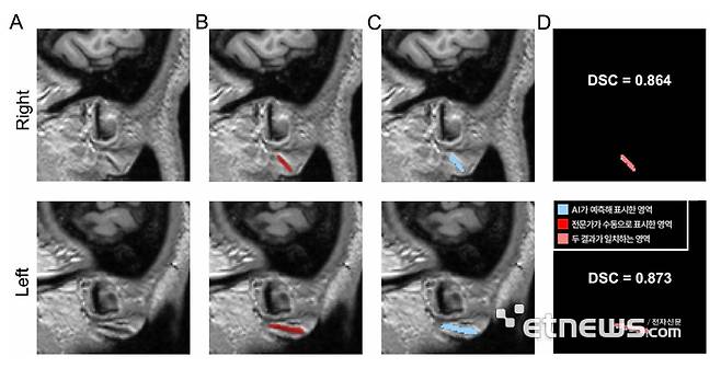 3차원 원본 이미지(A)를 토대로 전문가가 수동으로 직접 표시한 주름(B)과 AI가 예측해 자동으로 표시한 영역(C)