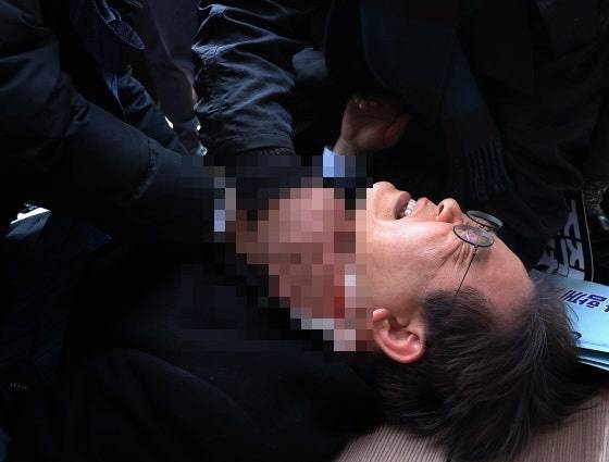 2024년 1월2일 이재명 당시 더불어민주당 대표가 부산 가덕도 대항전망대에서 괴한에 흉기로 습격을 당한 당시 모습. 연합뉴스