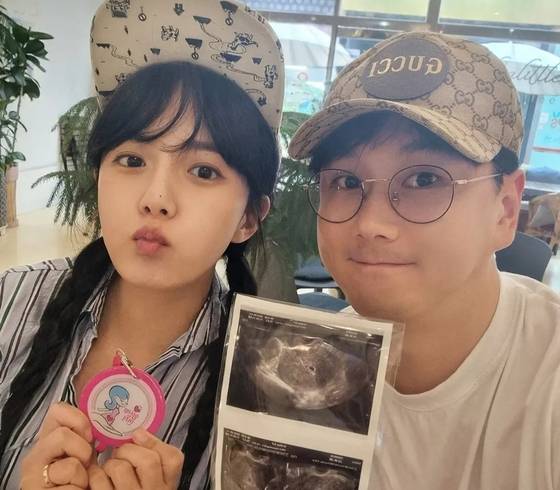 강은비, 임신 21주만 유산 고백 “사랑해 내 아기”