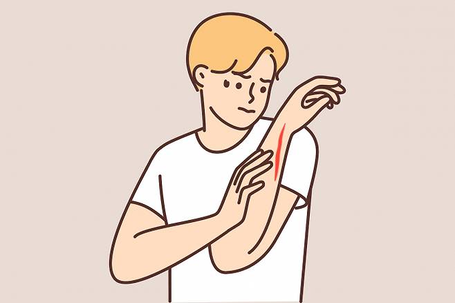적절한 찰과상 치료법이 주목된다. 사진은 기사 내용과는 무관함. /사진=클립아트코리아