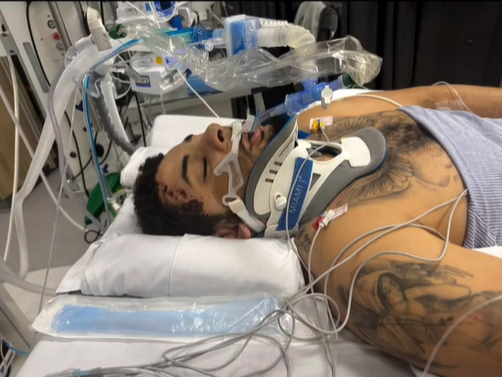 ‘음주운전 차량에 치여 다리 절단’…’30세’ 나이에 축구 선수 커리어 마감→가해자는 고작 징역 ‘28개월’