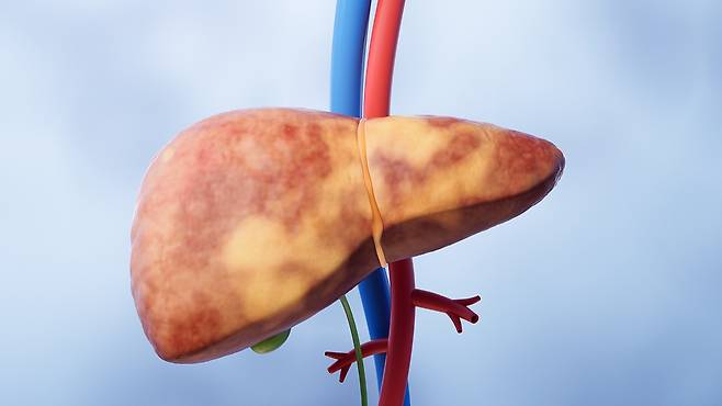 간 초음파로 간 실질의 상태를 관찰하고 간 내에 병변이 존재하는지 평가할 수 있다|출처: 클립아트코리아