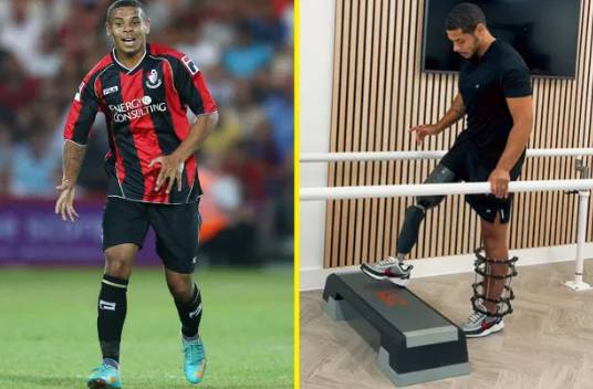 AFC본머스 시절 조던 치에도지(왼쪽)와 다리절단 수술 후 재활 중인 모습. /사진=영국 토크스포츠 갈무리