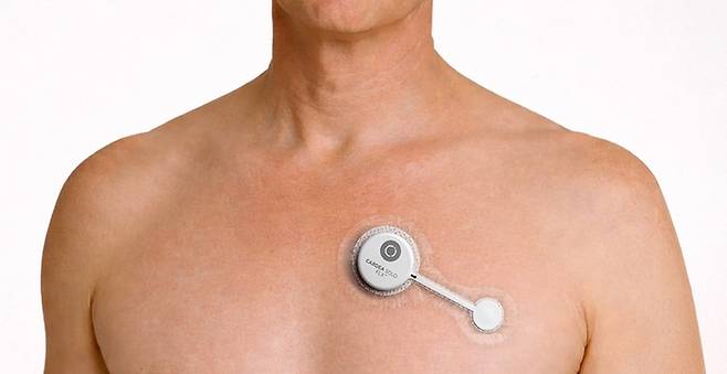 드림텍의 웨어러블 심전도(ECG) 모니터링 솔루션 '카디아솔로 FLX'