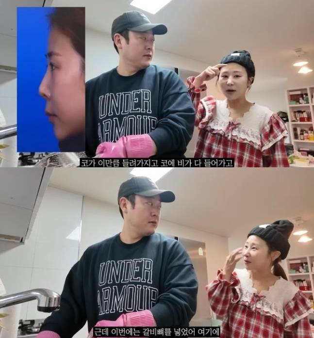 개그우먼 박세미가 코 재수술을 받았다고 밝혔다. /사진=박세미 유튜브 영상 갈무리