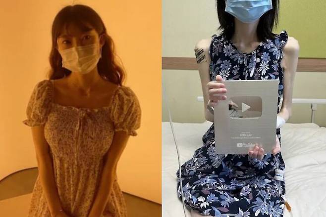 유튜버 '유병장수걸(유병장수girl)'이 신장암 투병 끝 세상을 떠났다. 그의 유튜브 채널은 구독자 20만명을 넘기며 유튜브에서 실버 버튼을 받았다. 사진=유병장수girl 유튜브 채널