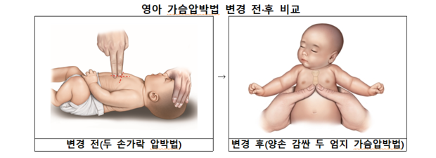 영아 가슴압박법 변경 전·후 비교. 질병관리청
