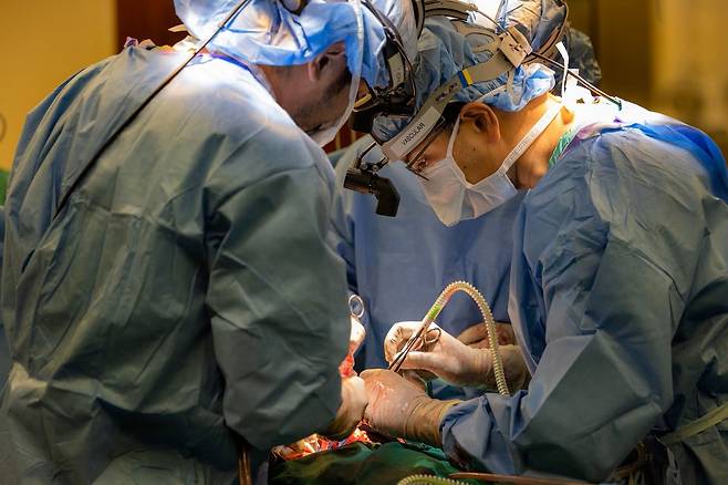 2023년 5월  미국 시카고 노스웨스턴 메디슨 병원의 안킷 바라트(Bharat) 교수팀은 33세 남성 환자의 폐 두 개를 모두 제거하고 인공 폐를 연결하는 12시간짜리 대수술을 진행했다. /노스웨스턴 메디슨 병원