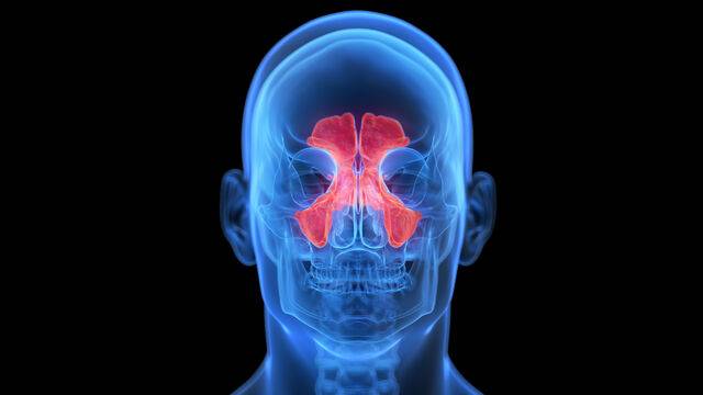 코 종양은 코 안쪽, 부비동 등에서 생기는 비정상적인 조직 덩어리를 말한다. 클립아트코리아