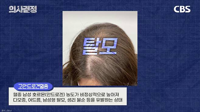 두번째봄 여성의원 정선화 원장 편 '의사결정' 유튜브 캡처