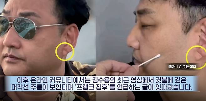 방송인 김수용의 귓불 주름이 포착된 방송 장면 ⓒYTN 캡쳐