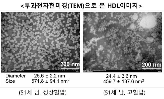 좋은 콜레스테롤이라고 불리는 HDL의 품질이 향상되면 고혈압 발병 위험이 줄어든다는 한국인 대상의 연구 결과가 세계 최초로 발표됐다. /사진=레이델 코리아 제공