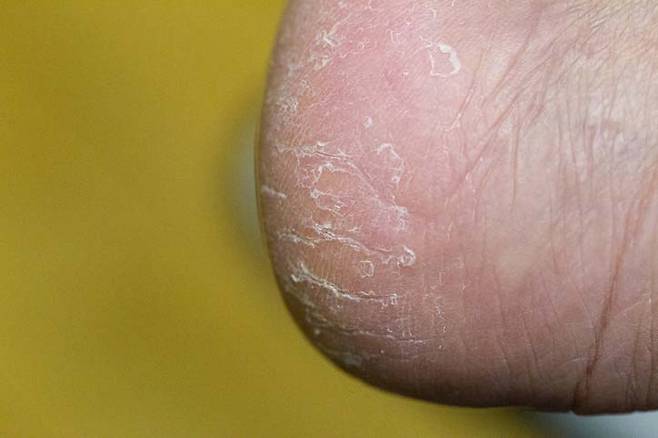 사진=게티이미지뱅크