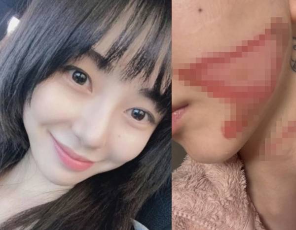 사진=권민아 SNS