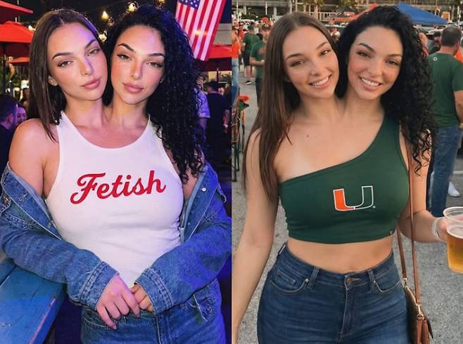 최근 화제가 된 미녀 샴쌍둥이가 AI로 생성된 사실이 밝혀지면서 논란이 일고 있다./사진=데일리메일