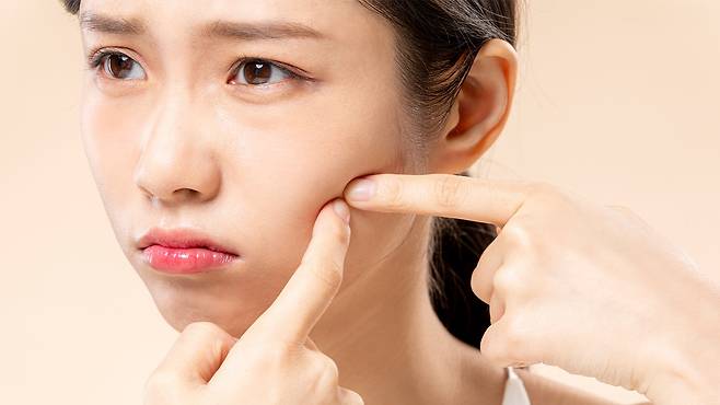 여드름 연고는 소량을 정확한 부위에 꾸준히 사용하는 것이 핵심이다｜출처: 클립아트코리아