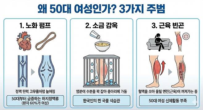 하지정맥류 환자 60%가 여성, 50대부터 ‘종아리 펌프’ 고장 급증 . 제미나이 생성 그래픽