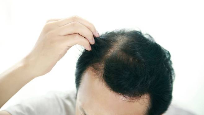 겨울철에는 보습 관리와 정전기에 주의하며 탈모 관리를 해야 한다|&nbsp;출처:&nbsp;클립아트코리아