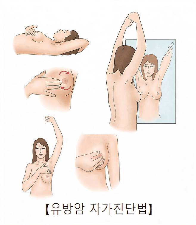 유방암 자가진단법