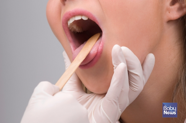 말을 하거나 음식을 씹을 때마다 혀가 따갑고 화끈거리지만 검사상 뚜렷한 이상이 없다면, 이는 구강 점막의 감각 신경이 예민해진 구강작열감증후군일 가능성이 있으며, 단순한 입안 문제라기보다 호르몬 변화·구강건조·영양 결핍·전신질환·스트레스·자율신경 불균형 등 전신적 요인이 복합적으로 작용하는 상태로 이해해야 합니다. ⓒ베이비뉴스