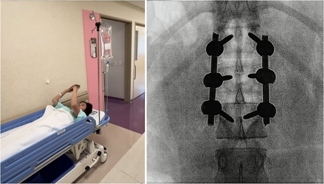 "목숨 건 900도 회전은 최가온의 의지"… 18세