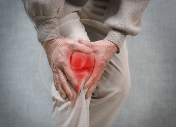 무릎 관절염, '완치'보다 '관리'… 내 무릎 단계에 맞는 치료법 찾아야｜출처: 클립아트코리아