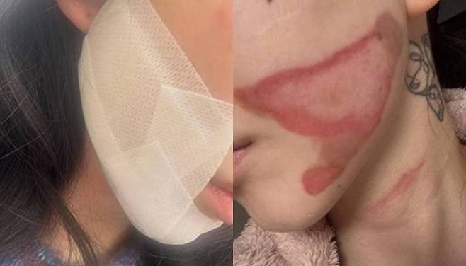 /사진=권민아 SNS