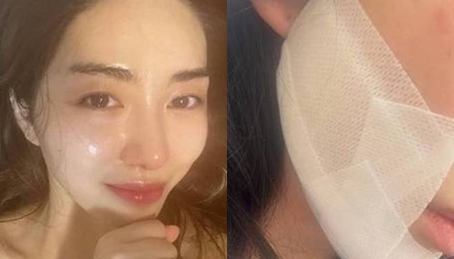 사진 I 권민아 SNS