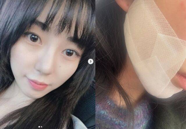 그룹 AOA 출신 권민아가 23일 새벽 "용기 1g만 더 내게 있었더라면 나는 성공할 수 있었을까? "라며 불안한 심경 글과 볼에 거즈를 붙인 사진을 남겼다./권민아 소셜미디어