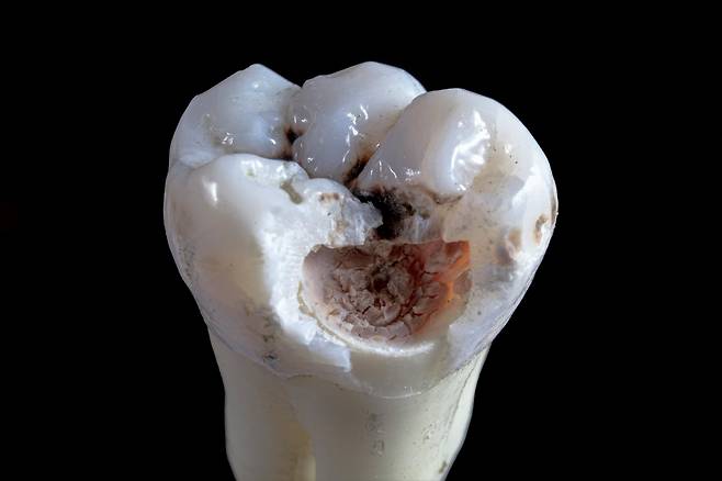 칫솔질 압력이 3N을 초과할 경우 치아와 잇몸 경계의 마모 위험이 높아질 수 있다는 연구 보고가 있다. unsplash
