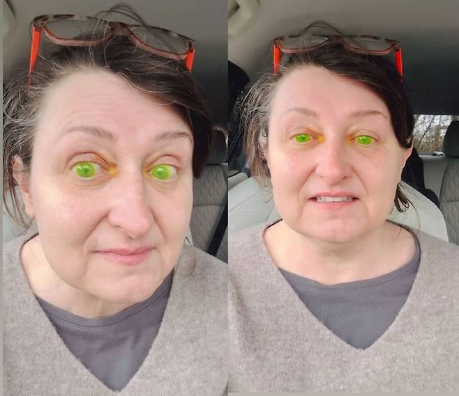 눈동자가 형광 녹색으로 변한 아일랜드 여성 마가리타 워골라. [인스타그램(@margoinireland) 캡처]