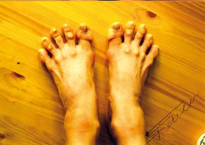 하루에도 수천번 토슈즈 발끝으로 서면 발은 땀에 절어 물집이 생기고 피부가 허물어지고 발톱은 예사로 빠졌다. 관절이 튀어나오고 굳은살과 근육이 도드라지는 강수진의 발 사진은 남편이 “이런 희귀한 발은 사진으로 남겨둬야 한다”며 찍어 집 안에 걸어뒀던 것. 외환위기의 고통을 딛고 다시 뛰기 시던 한국은 그 발에 담긴 고통과 용기와 희망에 감동했다. /인플루엔셜