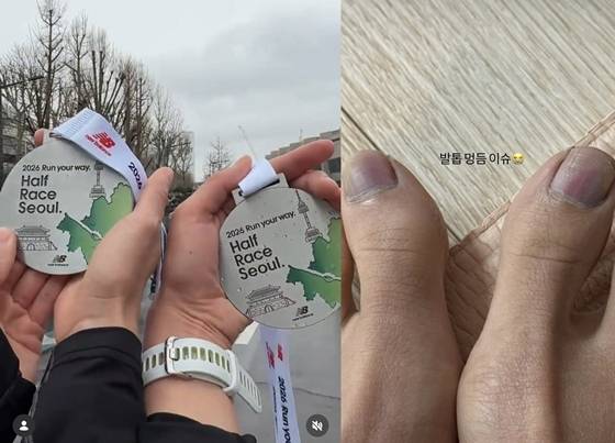 /사진=유이 인스타그램