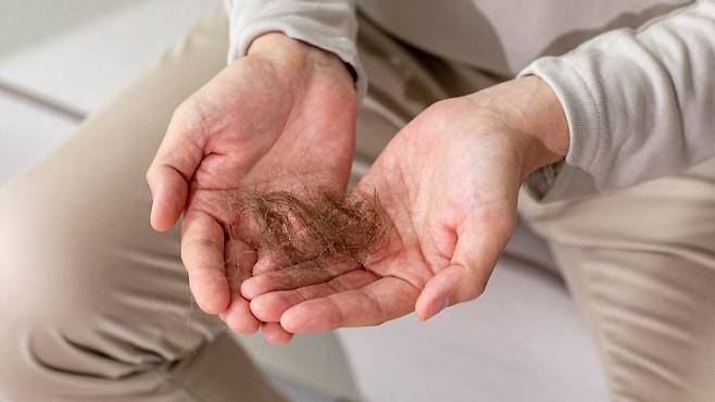 탈모는 호르몬, 유전, 스트레스 등 복합적인 원인으로 발생할 수 있다|출처: 클립아트코리아