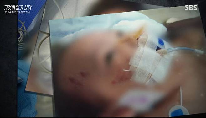 입원 후 치료를 받던 아기의 모습. 입원 나흘만에 아기는 세상을 떠났다. 에스비에스(SBS) ‘그것이 알고싶다’ 방송 화면 갈무리