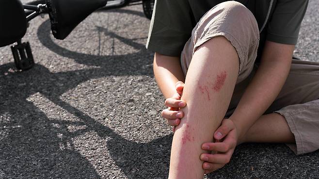 습윤 밴드는 긁히거나 까진, 얕은 상처에 효과적이다｜출처: 게티이미지뱅크