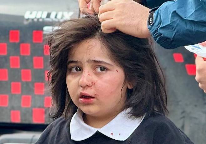 4일(현지시각) 이란 테헤란에서 미국과 이스라엘이 한 빌딩을 폭격해 부상을 입은 한 여자아이가 응급 처치를 받고 있다. UPI 연합뉴스