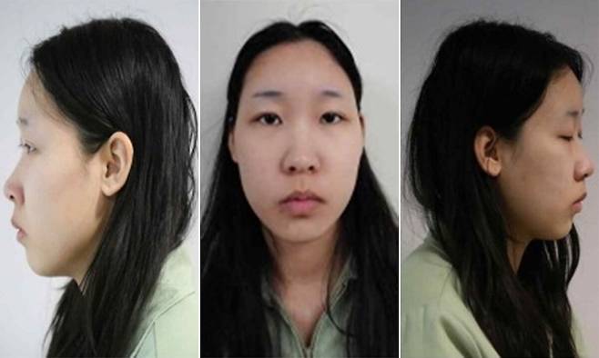 강북 모텔 연쇄살인 피의자 20세 김소영. 서울북부지검 제공