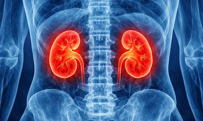 단백질 과다 섭취와 진통제 장기 복용 등 잘못된 생활습관이 콩팥 건강을 해칠 수 있어 정기검진과 관리가 필요하다. 챗GPT 생성 이미지