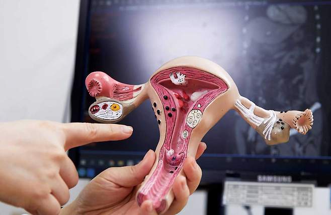 자궁의 하부 3분의 1을 자궁경부, 상부 3분의 2를 자궁체부라고 한다./사진=신지호 기자