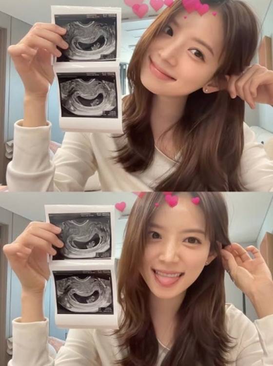 /사진=김지영 sns