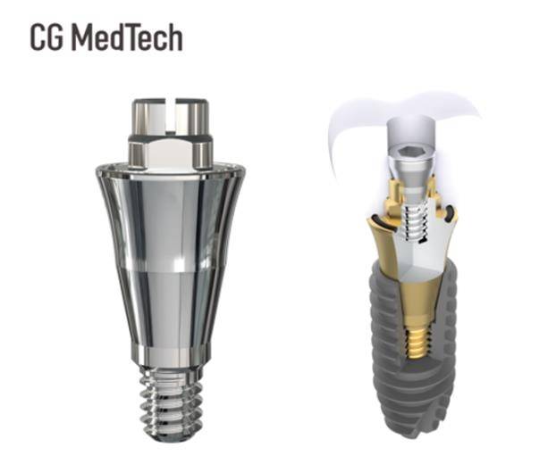 시지메드텍, 신제품 '우루덴트 SA' 출시 [시지메드텍 제공]