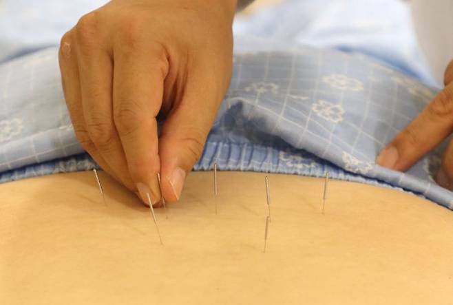 자생한방병원 의료진이 허리 통증을 호소하는 환자에게 침 치료를 실시하고 있다. 자생한방병원