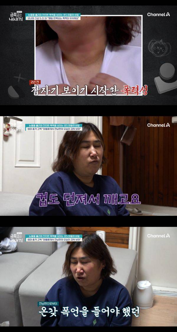 ⓒ채널A '요즘 육아-금쪽같은 내 새끼'