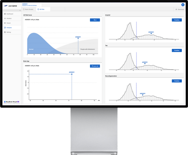 뷰브레인헬스케어의 인공지능(AI) 기반 2차원(2D) 자기공명영상(MRI) 분석 솔루션 '뷰브레인 모프'(사진=뷰브레인헬스케어)
